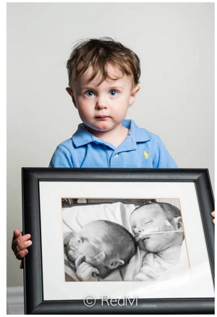 Illustration de l'article : Red Methot rend hommage aux bébés prématurés avec des photos avant/après qui font plaisir à voir ! 19 Clichés...
