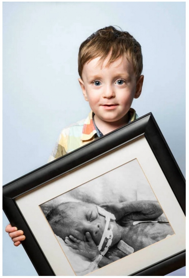 Illustration de l'article : Red Methot rend hommage aux bébés prématurés avec des photos avant/après qui font plaisir à voir ! 19 Clichés...