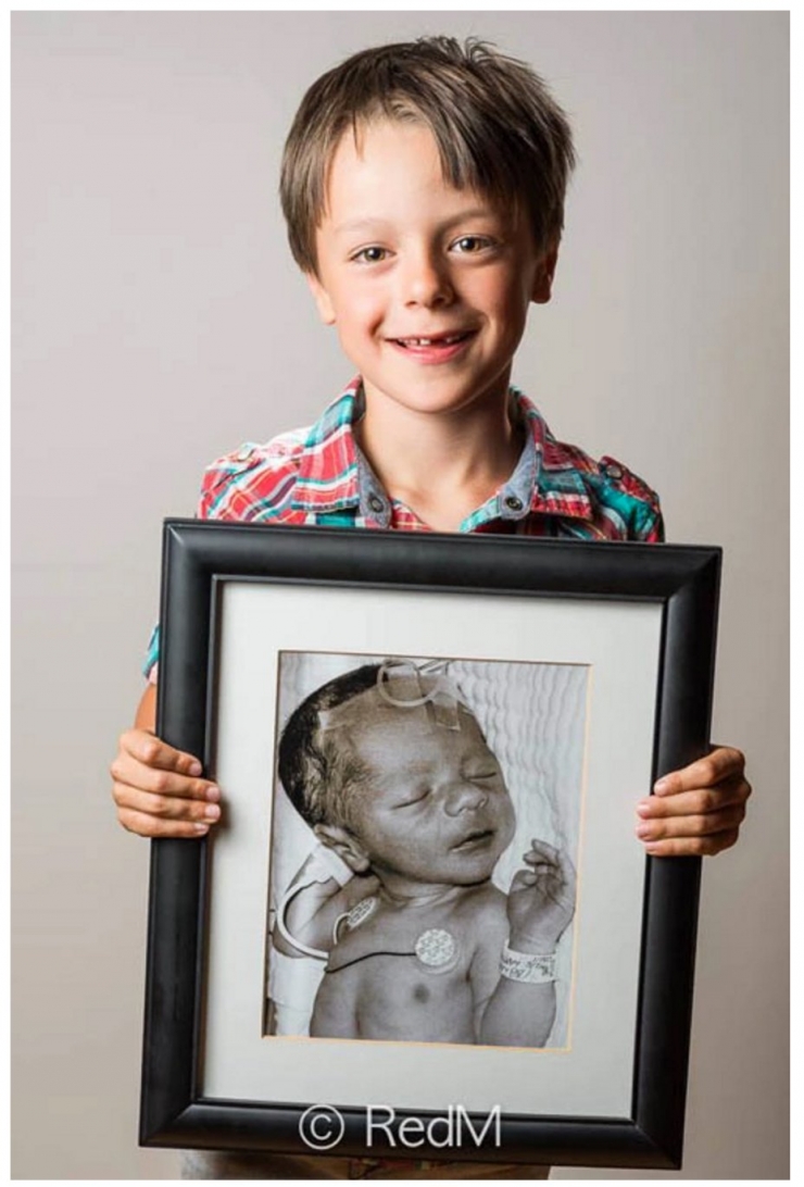 Illustration de l'article : Red Methot rend hommage aux bébés prématurés avec des photos avant/après qui font plaisir à voir ! 19 Clichés...