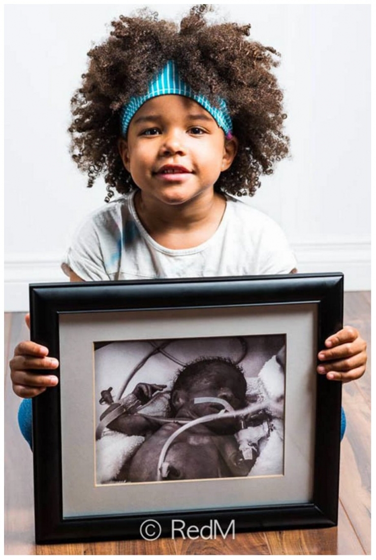Illustration de l'article : Red Methot rend hommage aux bébés prématurés avec des photos avant/après qui font plaisir à voir ! 19 Clichés...