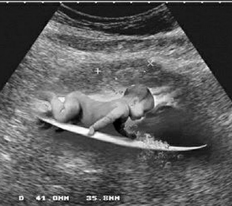 Illustration de l'article : Cette maman semble tout &agrave; fait normale, mais attendez de voir son corps de l&rsquo;autre c&ocirc;t&eacute;&hellip; Bravo pour son courage !