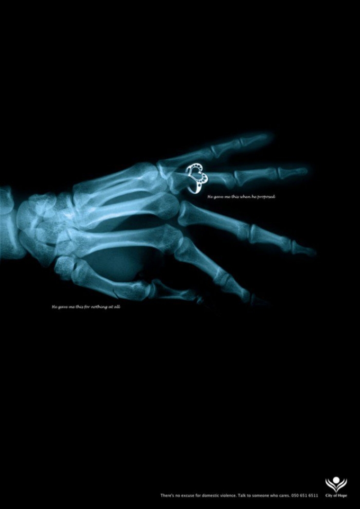 Illustration de l'article : D&eacute;couvrez ces 8 campagnes publicitaires de lutte contre les violences envers les femmes&hellip;Celle de la FNSF est vraiment choquante !