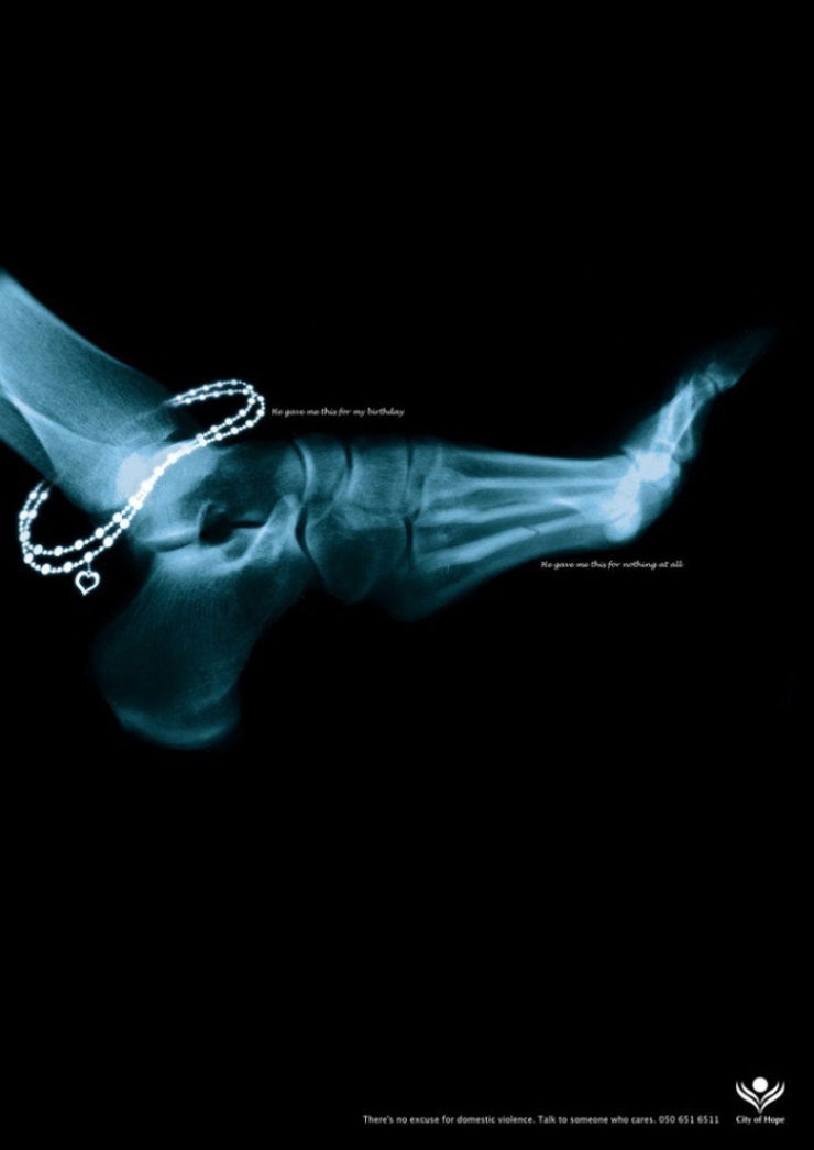 Illustration de l'article : D&eacute;couvrez ces 8 campagnes publicitaires de lutte contre les violences envers les femmes&hellip;Celle de la FNSF est vraiment choquante !