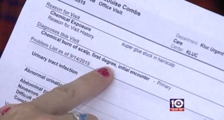 Illustration de l'article : Elle s'est fait brûler la tête après avoir subi des intimidations... Ce qu'une coiffeuse a fait pour elle est magnifique !