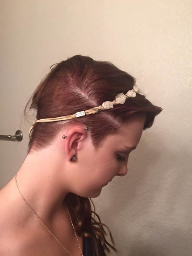 Illustration de l'article : Elle s'est fait brûler la tête après avoir subi des intimidations... Ce qu'une coiffeuse a fait pour elle est magnifique !