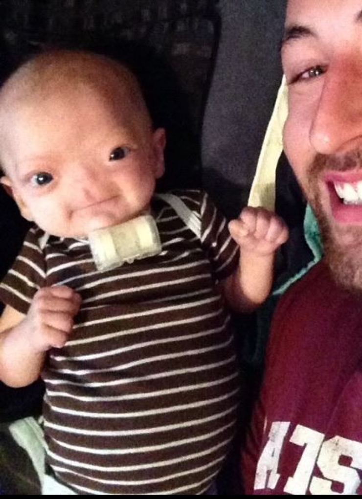 Illustration de l'article : N&eacute; sans nez, le petit Eli fait preuve d'un courage magnifique ! Ce qu'il est devenu fait plaisir &agrave; voir...