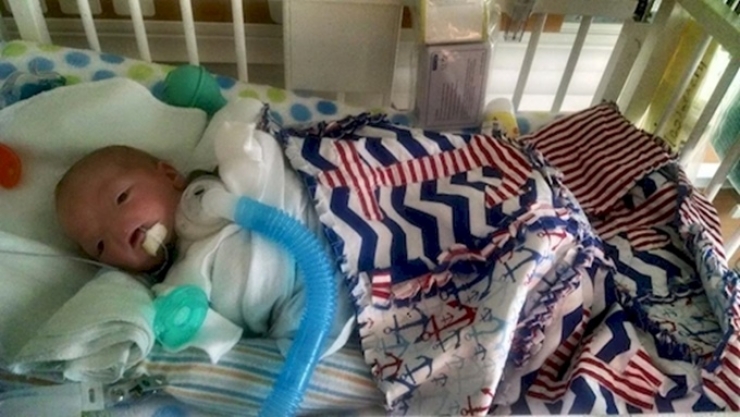 Illustration de l'article : N&eacute; sans nez, le petit Eli fait preuve d'un courage magnifique ! Ce qu'il est devenu fait plaisir &agrave; voir...