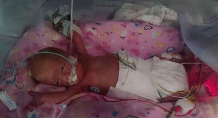 Illustration de l'article : Aussi incroyable que cela puisse paraitre, ce b&eacute;b&eacute; a &eacute;t&eacute; sauv&eacute; in extremis gr&acirc;ce &agrave; un sac en plastique...