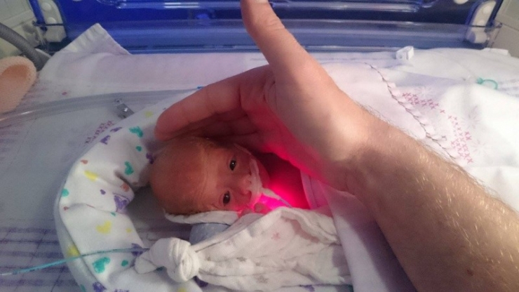 Aussi Incroyable Que Cela Puisse Paraitre Ce Bebe A Ete Sauve In Extremis Grace A Un Sac En Plastique Aussi Incroyable Que Cela Puisse Paraitre Ce Bebe A Ete Sauve In Extremis Grace A Un Sac En Plastique