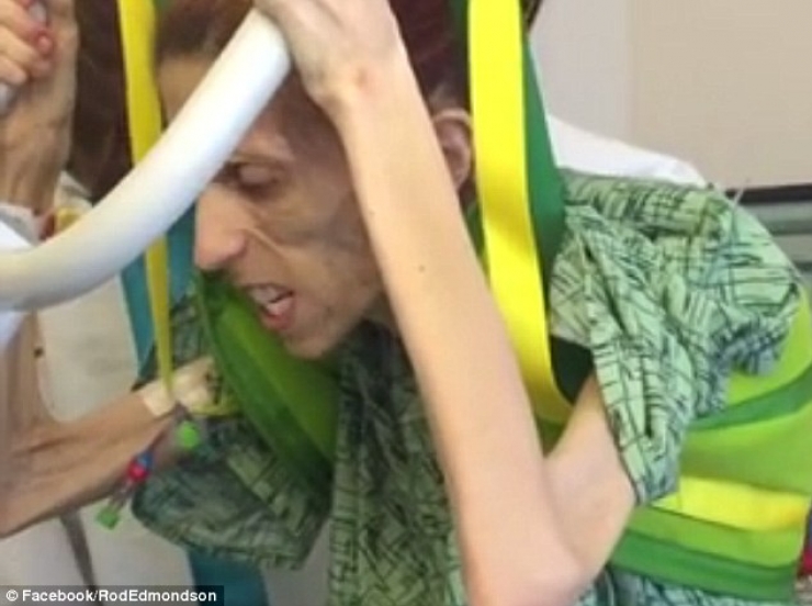 Illustration de l'article : En danger de mort avec un poids limite de 20kg, elle se prend en main et c&rsquo;est impressionnant de voir ce qu&rsquo;elle est devenue...