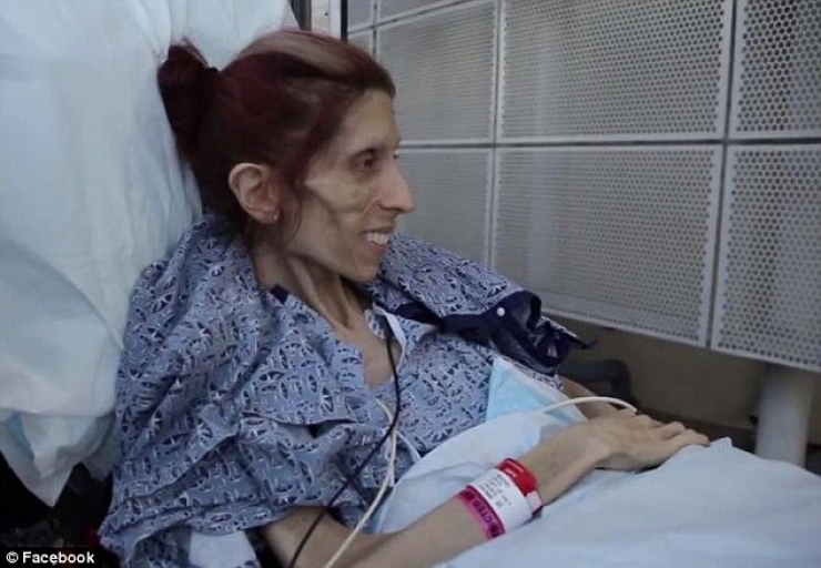 Illustration de l'article : En danger de mort avec un poids limite de 20kg, elle se prend en main et c&rsquo;est impressionnant de voir ce qu&rsquo;elle est devenue...