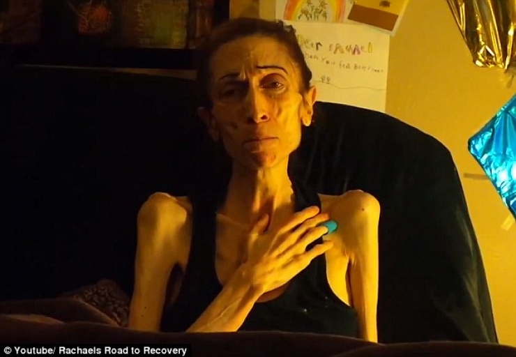 Illustration de l'article : En danger de mort avec un poids limite de 20kg, elle se prend en main et c&rsquo;est impressionnant de voir ce qu&rsquo;elle est devenue...