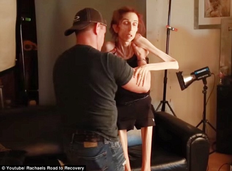 Illustration de l'article : En danger de mort avec un poids limite de 20kg, elle se prend en main et c&rsquo;est impressionnant de voir ce qu&rsquo;elle est devenue...