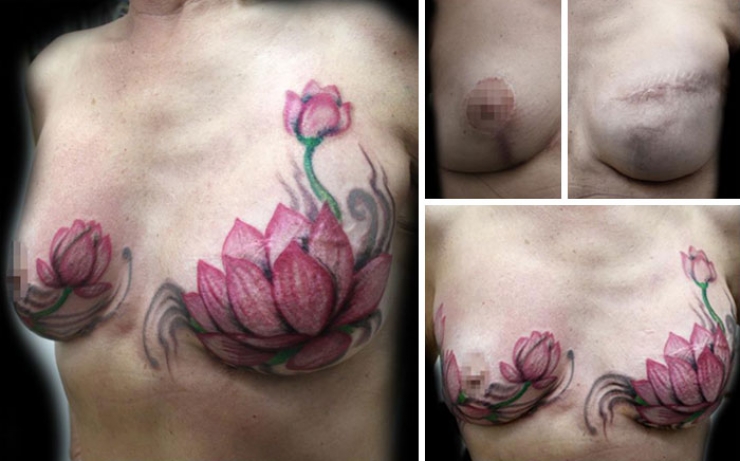 Illustration de l'article : Elle propose des tatouages gratuits pour couvrir les cicatrices de ces grandes blessées de la vie