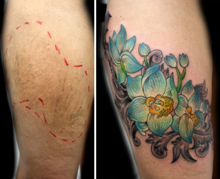 Illustration de l'article : Elle propose des tatouages gratuits pour couvrir les cicatrices de ces grandes blessées de la vie