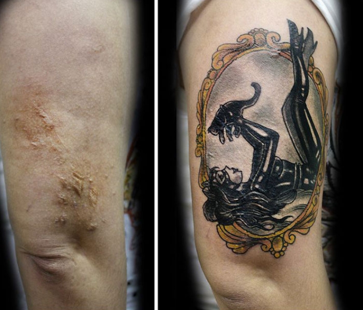 Illustration de l'article : Elle propose des tatouages gratuits pour couvrir les cicatrices de ces grandes blessées de la vie