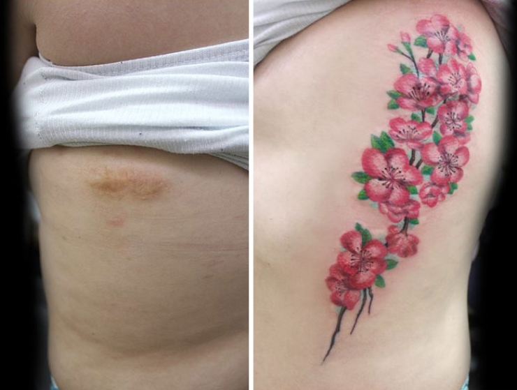 Illustration de l'article : Elle propose des tatouages gratuits pour couvrir les cicatrices de ces grandes blessées de la vie