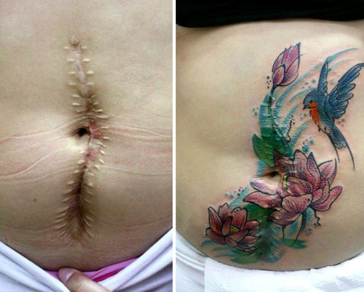 Illustration de l'article : Elle propose des tatouages gratuits pour couvrir les cicatrices de ces grandes blessées de la vie