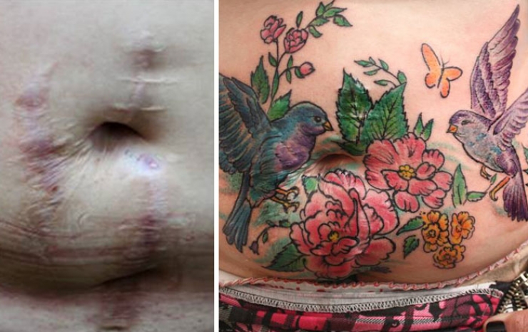 Illustration de l'article : Elle propose des tatouages gratuits pour couvrir les cicatrices de ces grandes blessées de la vie