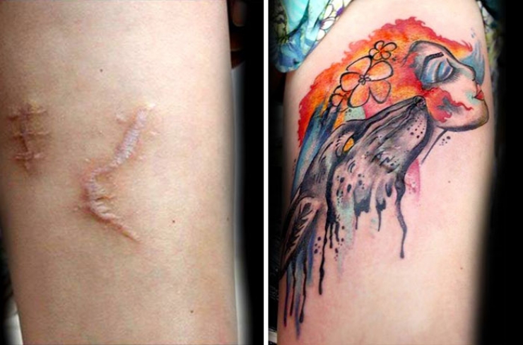 Illustration de l'article : Elle propose des tatouages gratuits pour couvrir les cicatrices de ces grandes blessées de la vie
