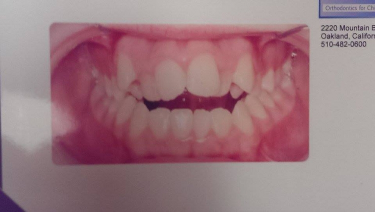 Illustration de l'article : Les étudiants de son bahut la traitaient de monstre... Regardez ce qu'elle est devenue !