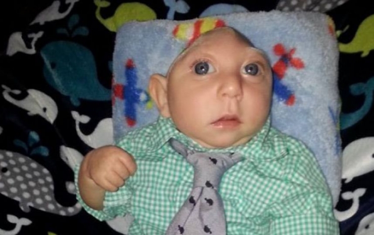 Illustration de l'article : Ce petit bout est un miracle, toujours en vie malgré l'avis des médecins et sa malformation au crâne...