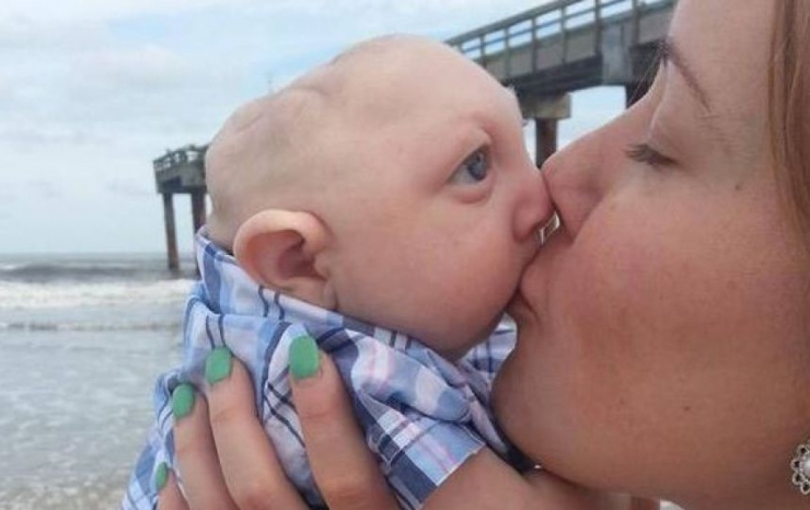 Illustration de l'article : Ce petit bout est un miracle, toujours en vie malgré l'avis des médecins et sa malformation au crâne...