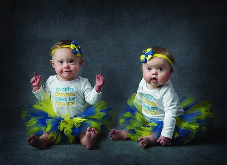 Illustration de l'article : Atteints de trisomie 21, ces bébés sont tout simplement magnifiques dans ce calendrier caritatif...