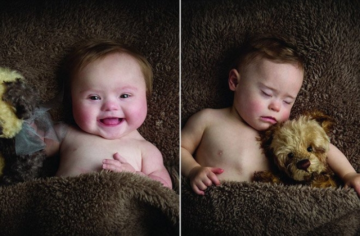 Illustration de l'article : Atteints de trisomie 21, ces bébés sont tout simplement magnifiques dans ce calendrier caritatif...