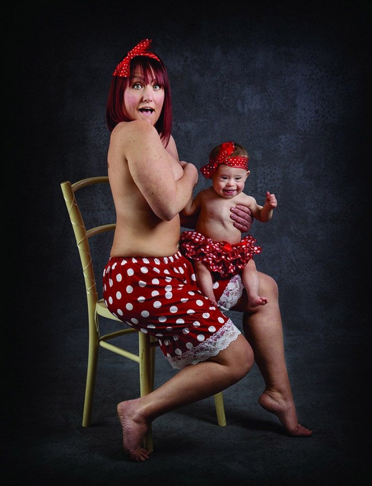 Illustration de l'article : Atteints de trisomie 21, ces bébés sont tout simplement magnifiques dans ce calendrier caritatif...