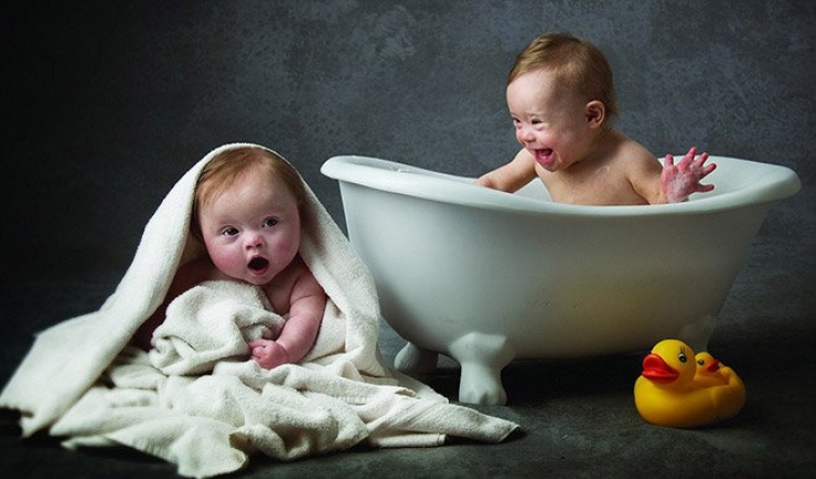 Illustration de l'article : Atteints de trisomie 21, ces bébés sont tout simplement magnifiques dans ce calendrier caritatif...