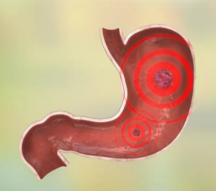 Illustration de l'article : Il ne faut JAMAIS jeter le jus de vos bols de cornichons ! Regardez ce que vous pouvez faire avec...