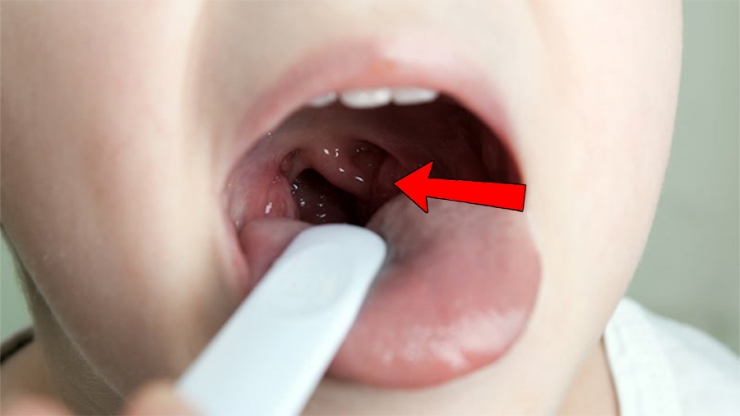 Illustration de l'article : 10 parties du corps "inutiles" qui pourraient dispara&icirc;tre sans que ce soit handicapant pour l'homme !