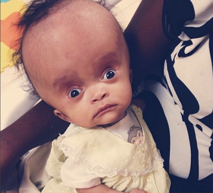 Illustration de l'article : Trouvé dans un tas d'ordures, regardez ce que ce bébé est devenu 2 ans plus tard, grâce a beaucoup d'amour...