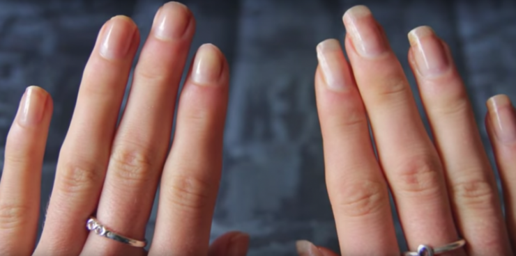 Illustration de l'article : Trempez vos mains dans ces 2 produits que tout le monde connait ! Les r&eacute;sultats sont &eacute;patants, juste apr&egrave;s deux semaines !