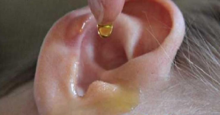 Illustration de l'article : La meilleure des astuces de grands-m&egrave;res pour se d&eacute;barrasser des infections et bouchons aux oreilles !