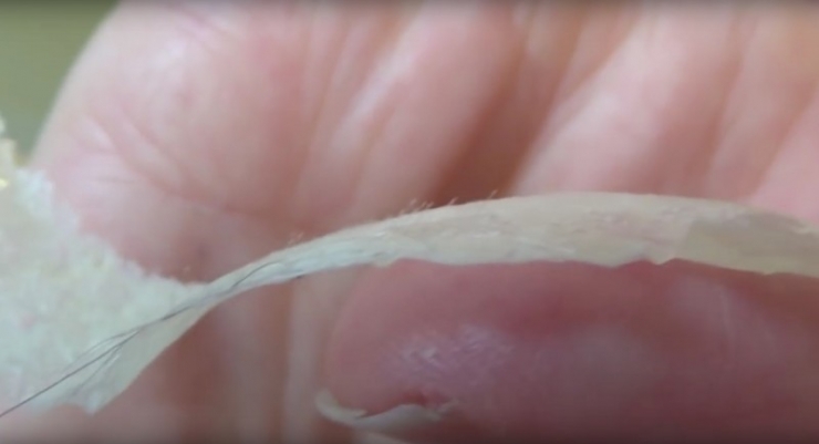 Illustration de l'article : Il vous suffit de ces deux ingr&eacute;dients pour vous d&eacute;barrasser de vos points noirs !