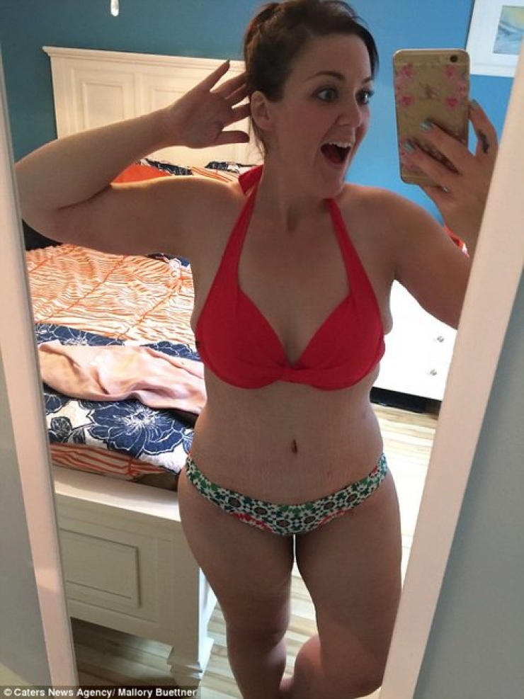 Illustration de l'article : Après un combat gagné contre son poids et une perte de 95 kilos, elle peut ENFIN porter un bikini.