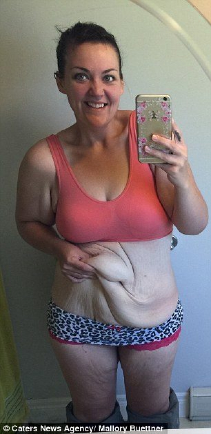 Illustration de l'article : Après un combat gagné contre son poids et une perte de 95 kilos, elle peut ENFIN porter un bikini.