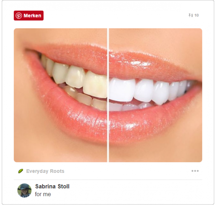 Illustration de l'article : Enfin une astuce qui fonctionne pour le blanchiment de nos dents ! 