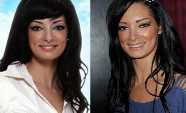 Illustration de l'article : 12 transformations &eacute;tonnantes de stars fran&ccedil;aises gr&acirc;ce &agrave; la chirurgie