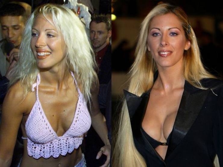 Illustration de l'article : 12 transformations &eacute;tonnantes de stars fran&ccedil;aises gr&acirc;ce &agrave; la chirurgie