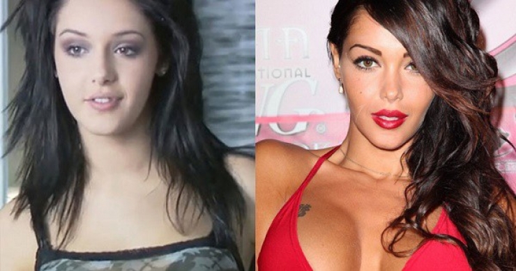 Illustration de l'article : 12 transformations &eacute;tonnantes de stars fran&ccedil;aises gr&acirc;ce &agrave; la chirurgie