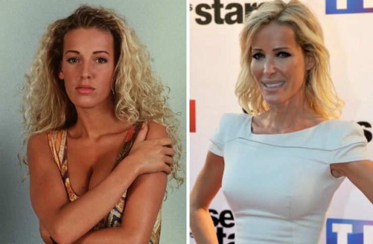 Illustration de l'article : 12 transformations &eacute;tonnantes de stars fran&ccedil;aises gr&acirc;ce &agrave; la chirurgie