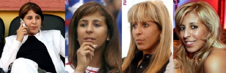 Illustration de l'article : 12 transformations &eacute;tonnantes de stars fran&ccedil;aises gr&acirc;ce &agrave; la chirurgie