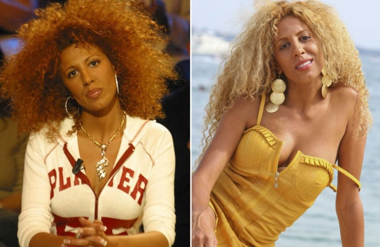 Illustration de l'article : 12 transformations &eacute;tonnantes de stars fran&ccedil;aises gr&acirc;ce &agrave; la chirurgie