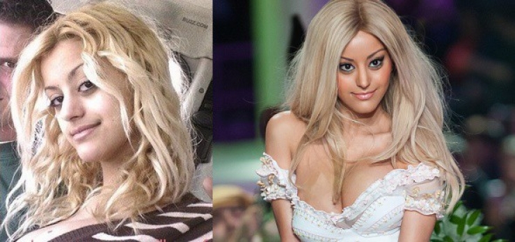 Illustration de l'article : 12 transformations &eacute;tonnantes de stars fran&ccedil;aises gr&acirc;ce &agrave; la chirurgie