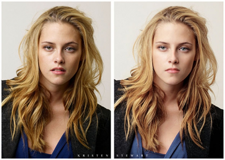 Illustration de l'article : 17 stars nous prouvent que personne n'est parfait ! Adieu Photoshop...