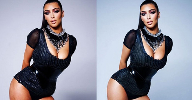 Illustration de l'article : 17 stars nous prouvent que personne n'est parfait ! Adieu Photoshop...
