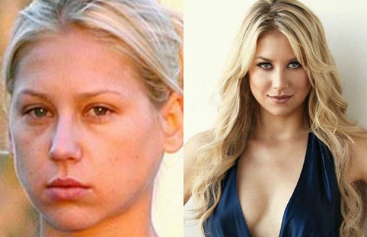 Illustration de l'article : 17 stars nous prouvent que personne n'est parfait ! Adieu Photoshop...